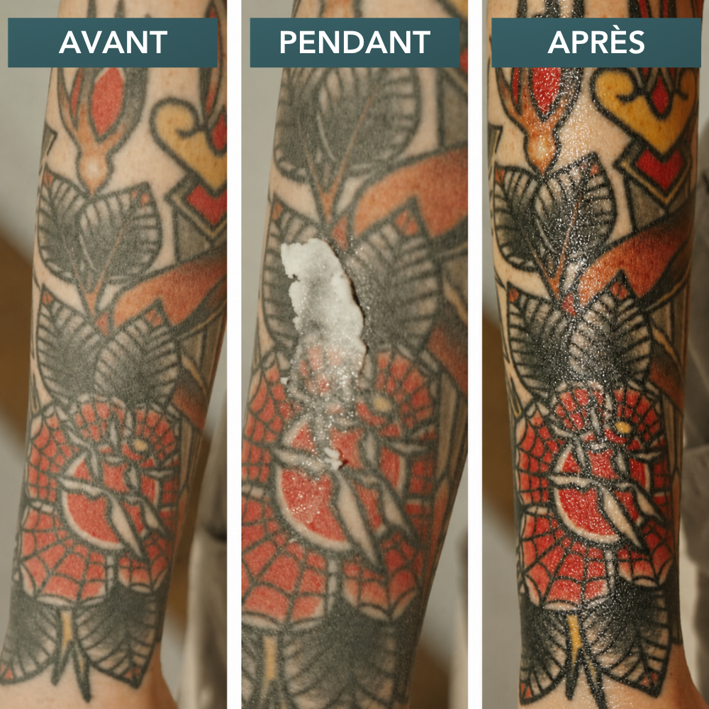 DERMYNK | Gel de Soin Aftercare Tatouage 12ml